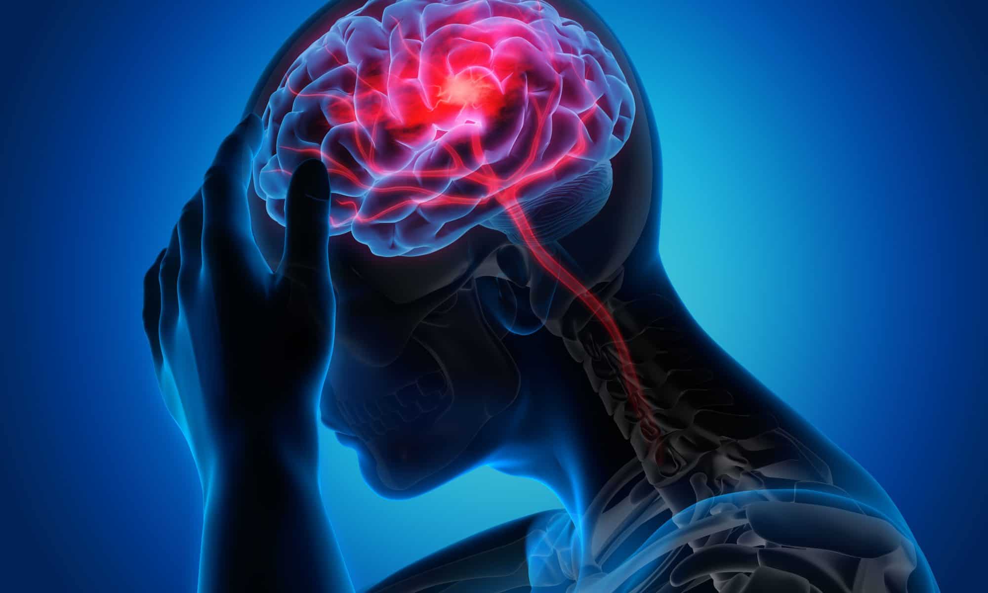 Image of brain - Paul Wagner